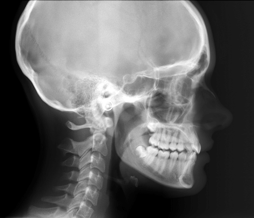 Cephalomatric Radiograph