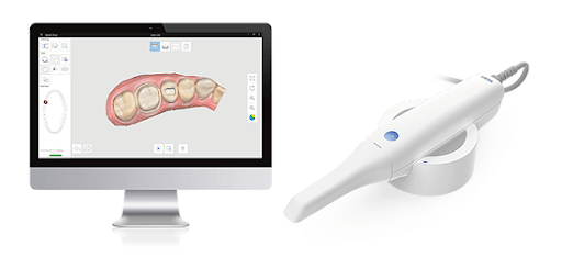 Intra Oral Scanner