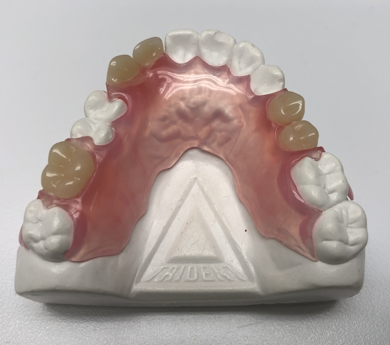 Partial Denture